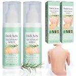 Los Mejores Productos Cosméticos para Eliminar Granos en la Espalda: Análisis y Comparativa de Eficacia